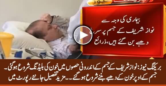 Breaking: Reddish Spots Appeared on Nawaz Sharif's Body Due to Internal Bleeding