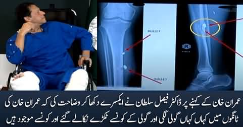 Dr. Faisal Sultan shows x-rays of Imran Khan's legs and explains where were the bullets in the body