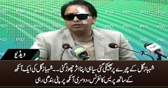 Effect of Ink Attack: Shahbaz Gill Doing Press Conference With One Eye