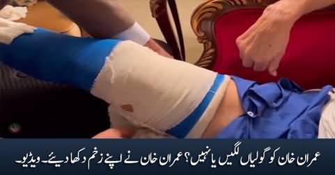 Exclusive video: Imran Khan showed his wounds while changing the bandage