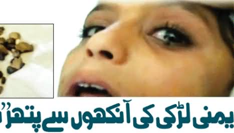 Instead of Tears Tiny Stones Drop From The Eyes of A Yemeni Girl