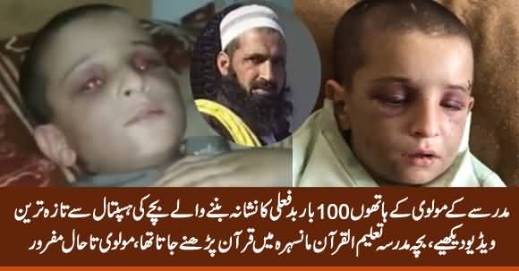 Mansehra Mein 100 Baar Ziadati Ka Nishana Banne Waale Bache Ki Hospital Se Latest Video