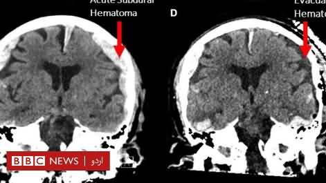New Research: What human eyes see just before death