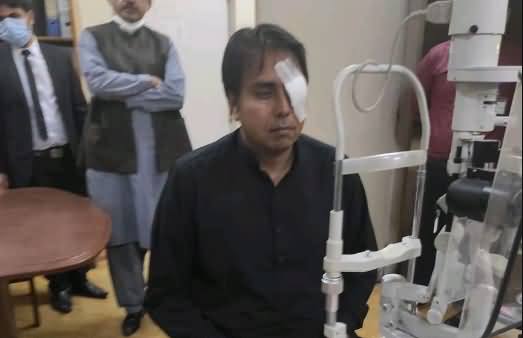 Shahbaz Gil Reached Hospital, Got An Infection in One Eye Due to Ink