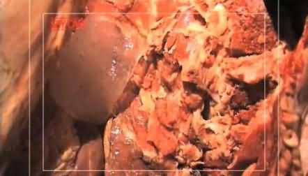 Sick and Dead Animals Meat is beaing Sold in Pakistan - Dunya News Exposed the Story