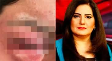 Tv Anchor Jasmin Manzoor faces domestic violence, shares her pictures on social media