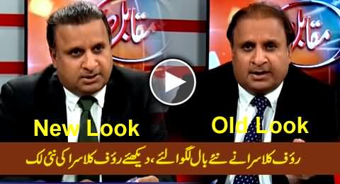 Watch New Graceful Look Of Rauf Klasra After Hair Transplant